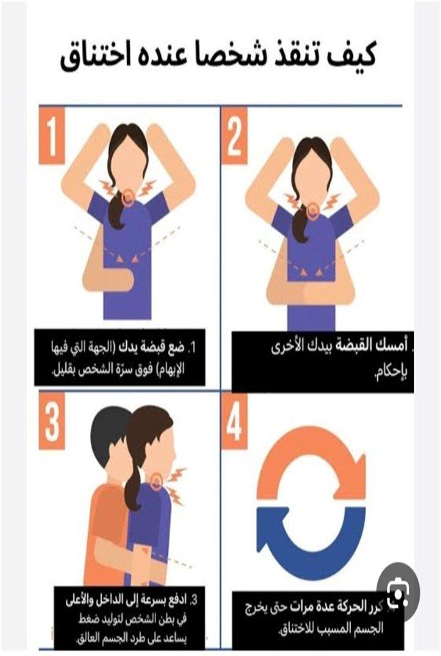 مناورة هاملشتين للاسعاف عند الاختناق